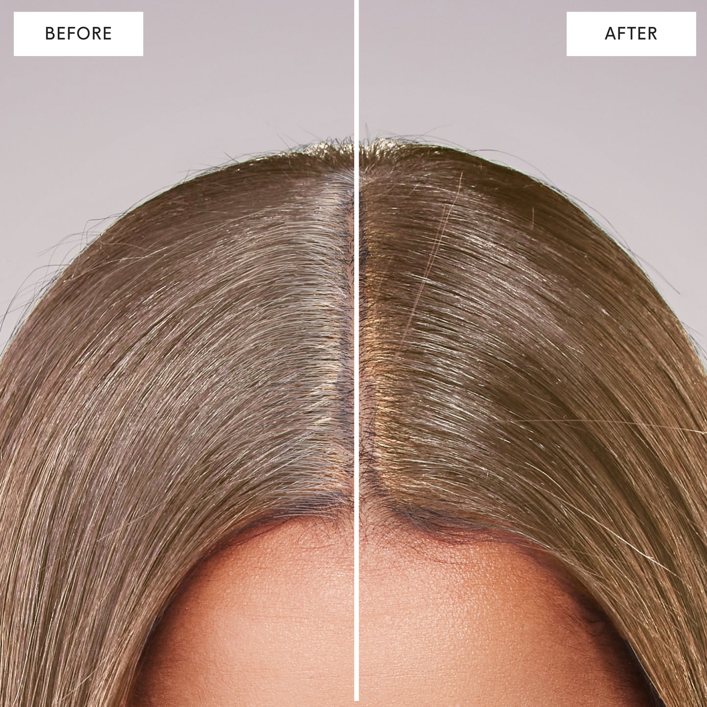 Medium Blonde