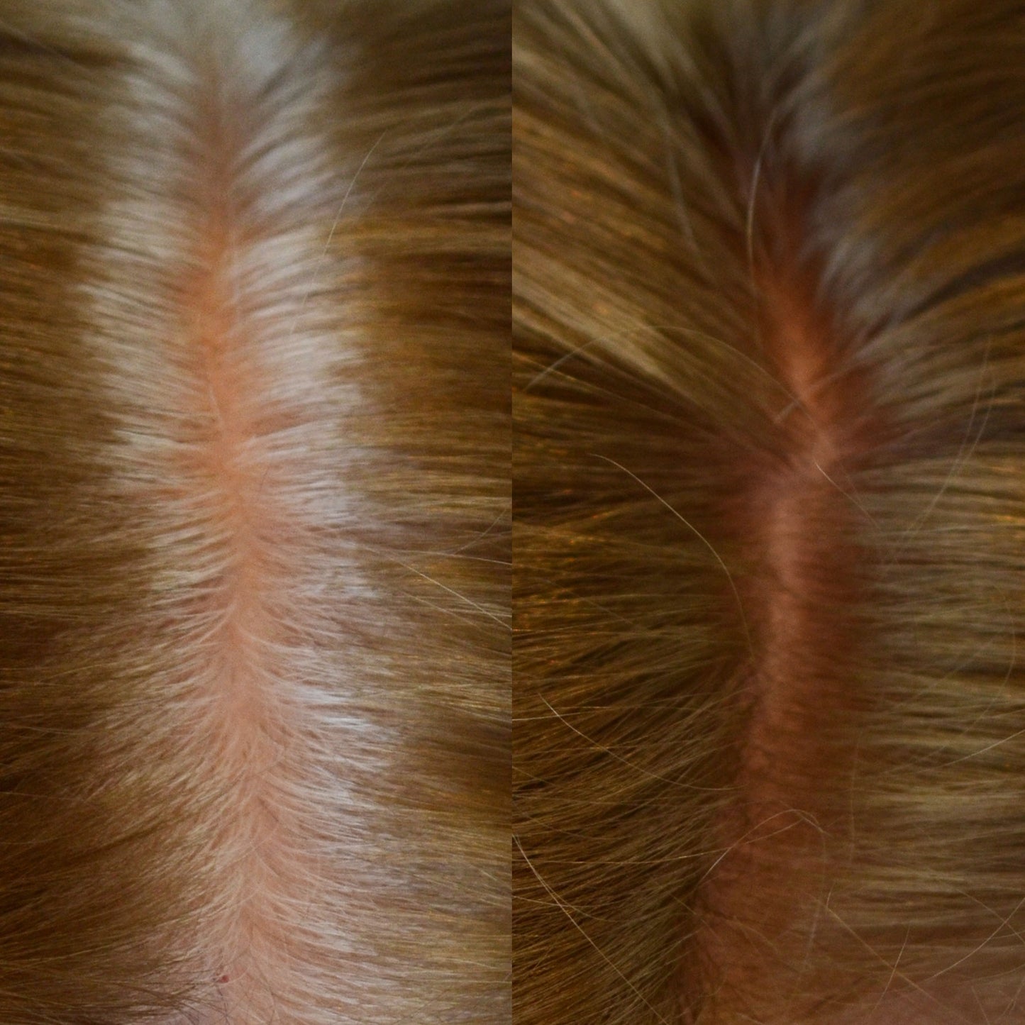 Medium Blonde